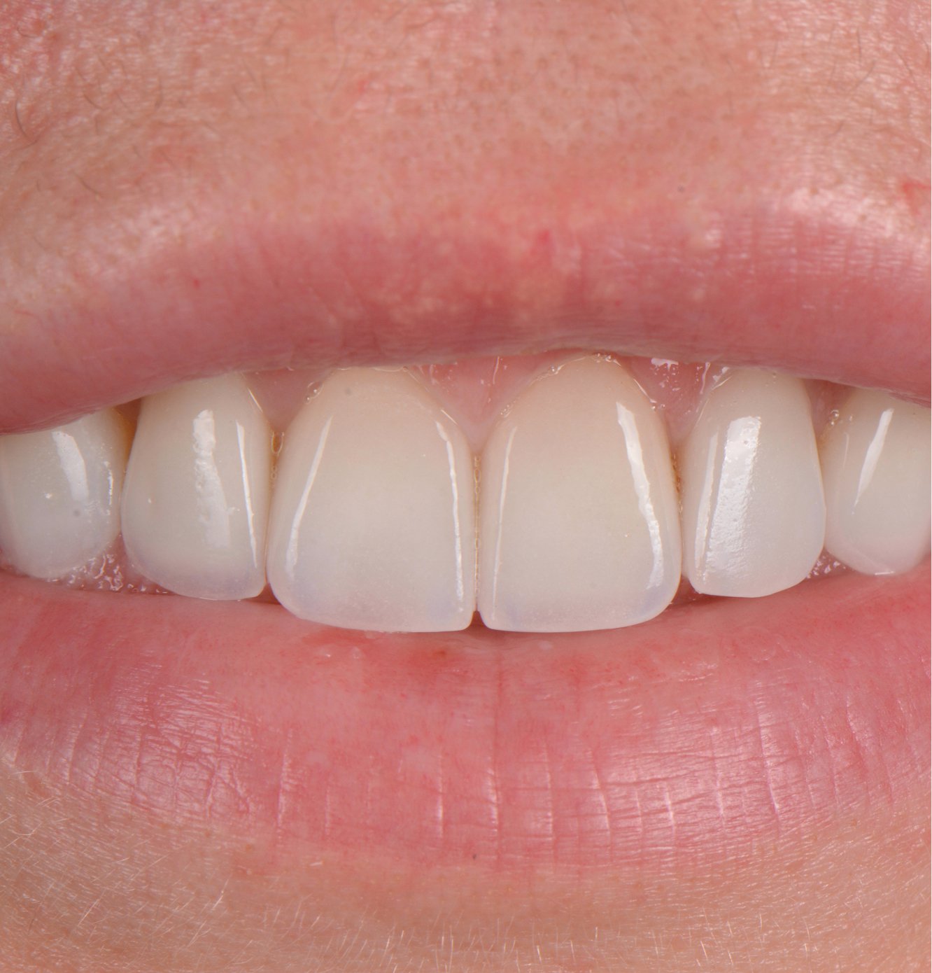 Lausanne Smile Besoins Soins Hygiene