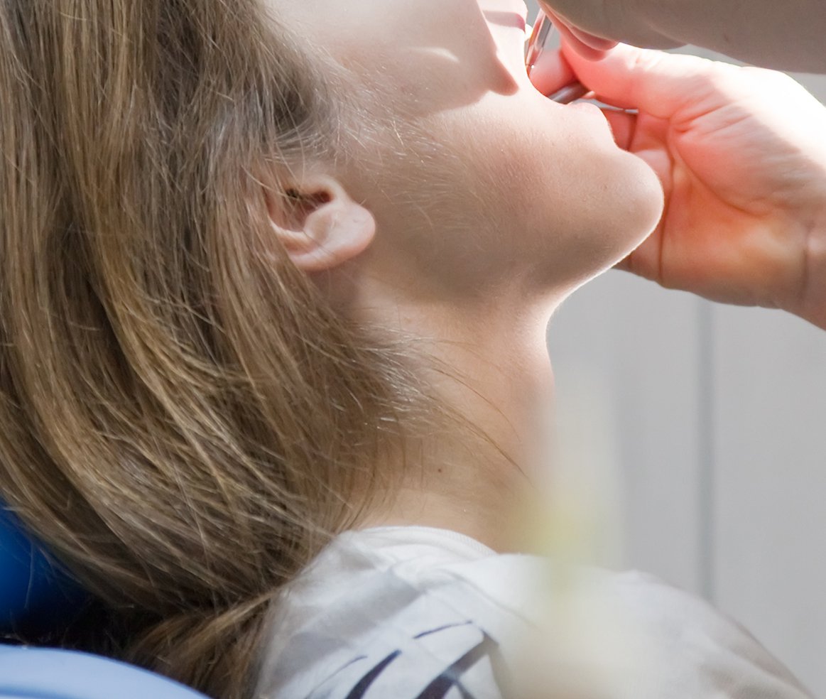 Lausanne Smile Besoins Soins Traitement Caries