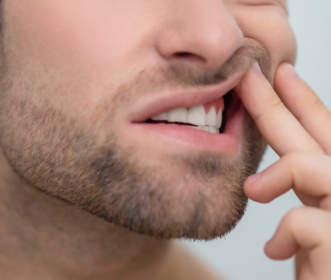 Lausanne Smile Besoins Soins Usures Erosions