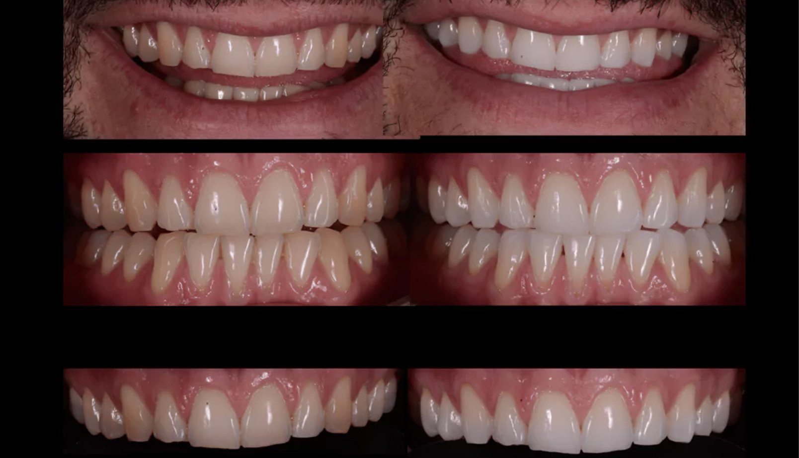 Lausanne Smile Besoins Voyez La Difference