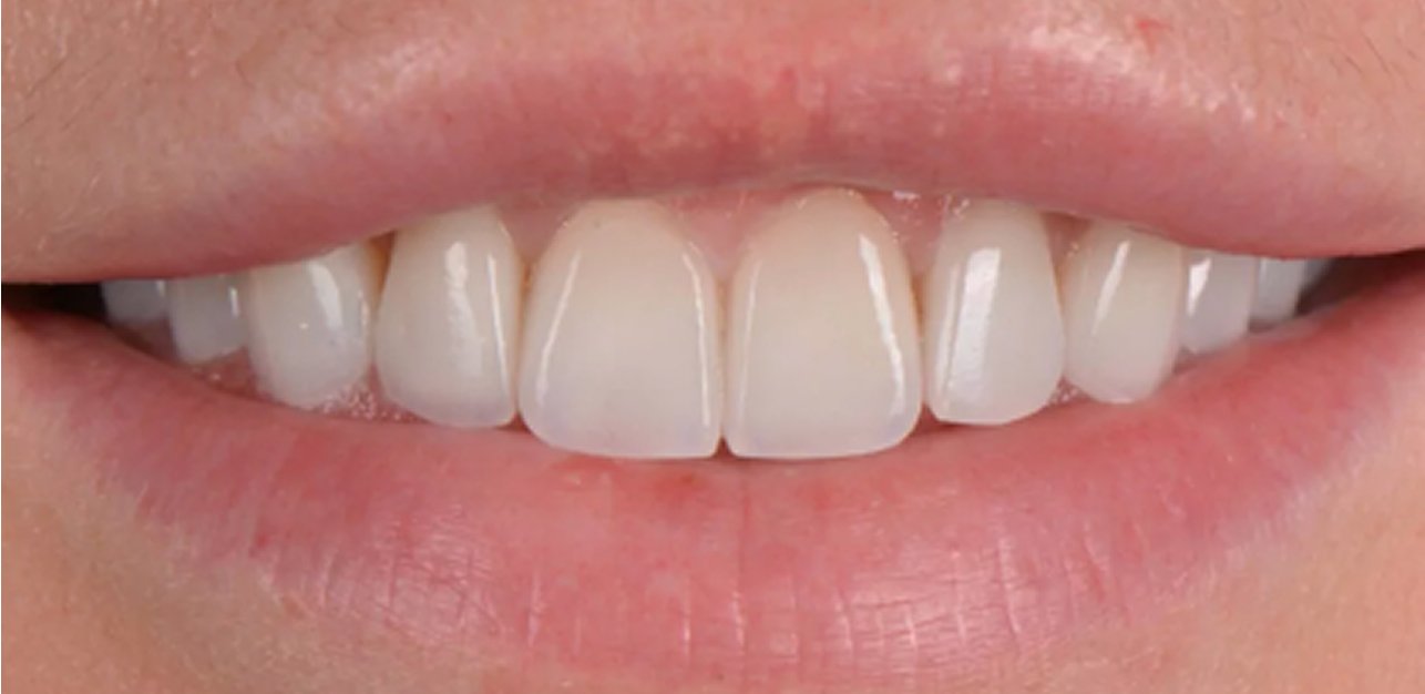 Lausanne Smile Home Medecine Dentaire Esthetique