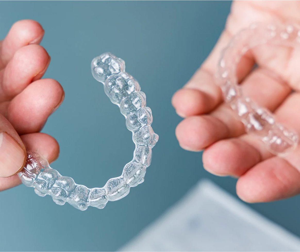 Lausanne Smile Services Dentaire Alignement Dentaire