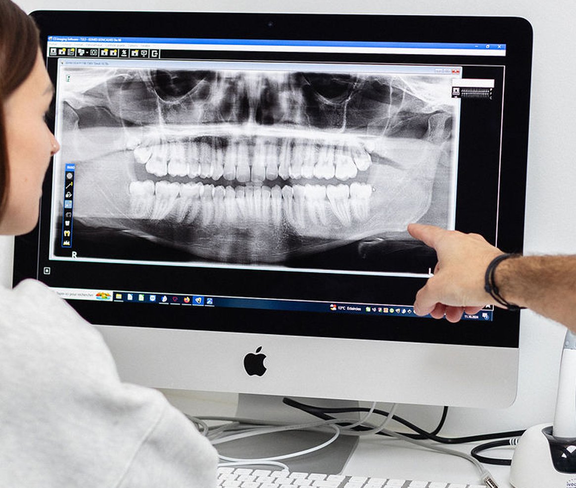 Lausanne Smile Services Dentaire Implant Dentaire