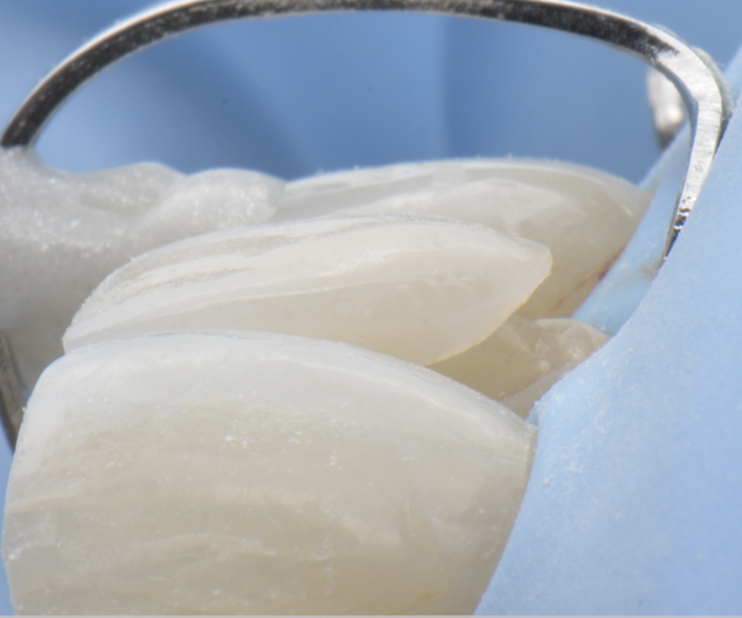 Lausanne Smile Erosions Dentaires Prendre Rdv